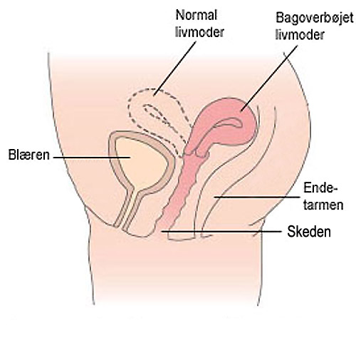 menstruationskop og svar