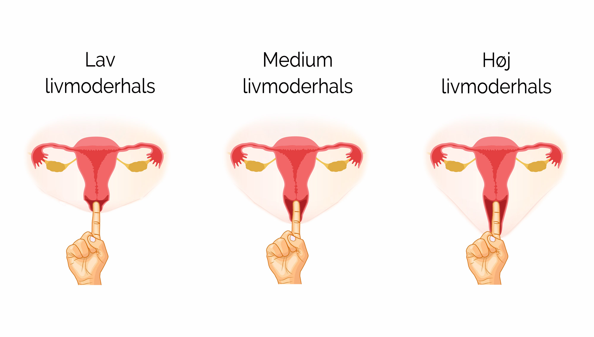 Lagring indlæg majs Menstruationskop størrelse - sådan vælger du rigtigt - Kopperiet.dk